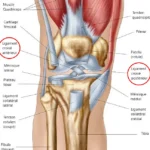 RUPTURE DES LIGAMENTS CROISÉS DU GENOU