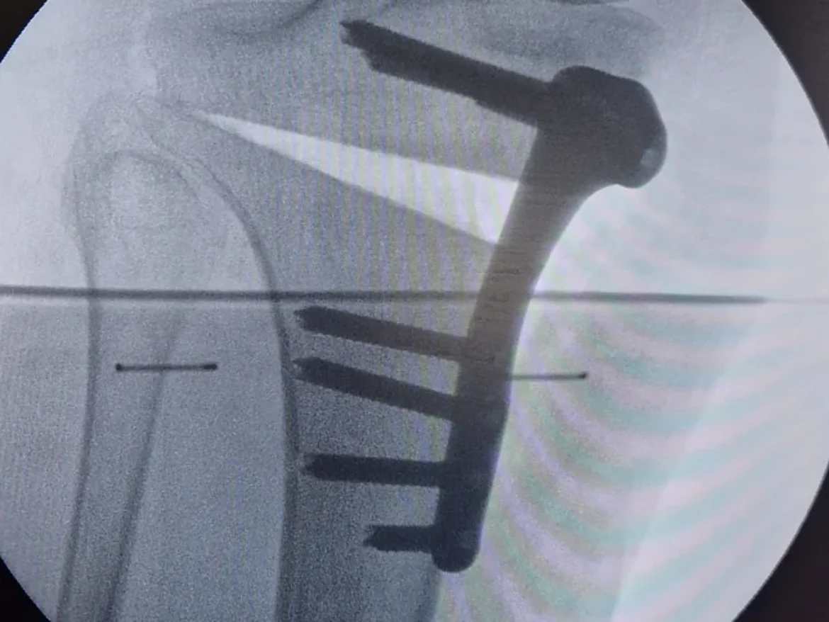 20221208_101858_edited