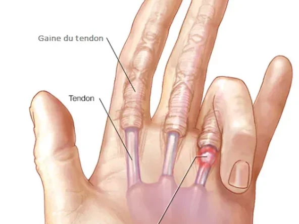 Capture d’écran 2023-05-07 112841