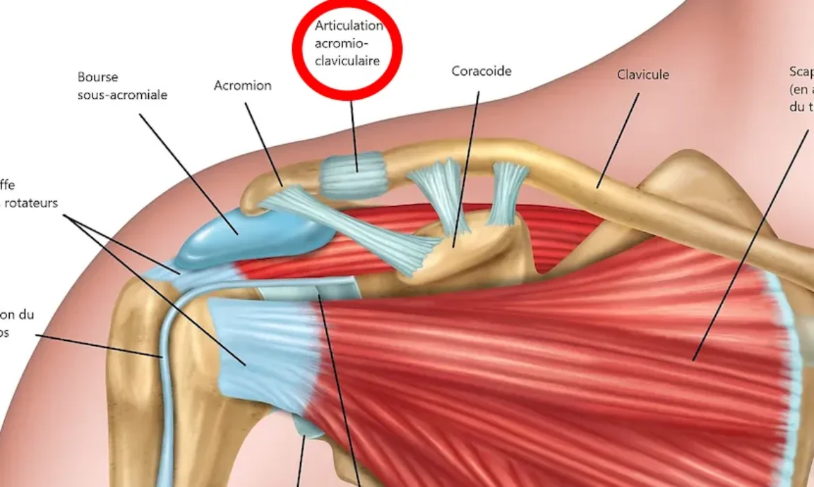 ACROMIOCLAVICULAR DISLOCATION