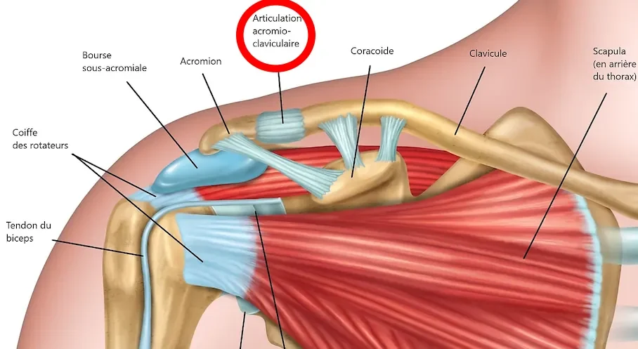 LUXATION ACROMIOCLAVICULAIRE