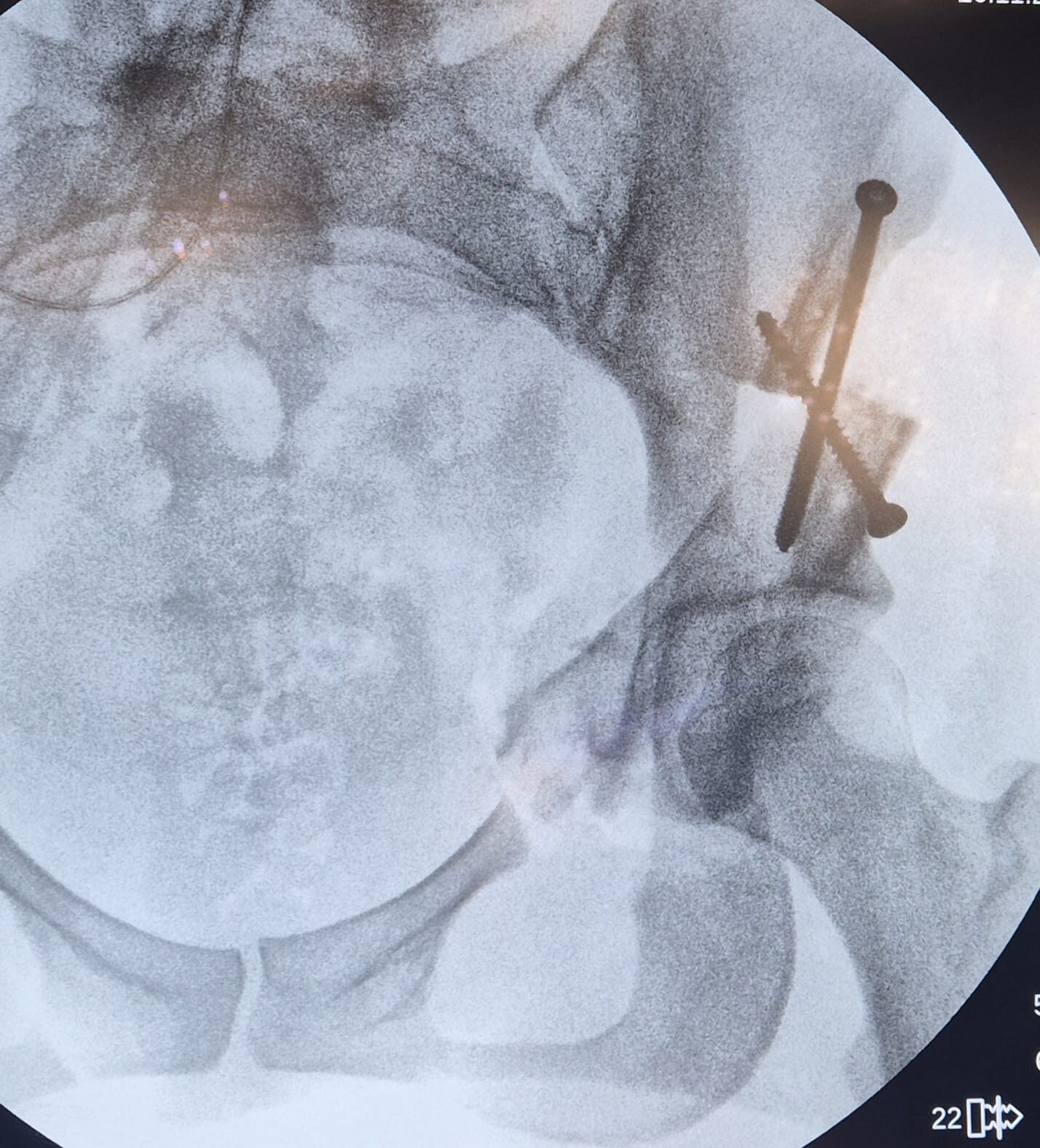 WhatsApp Image 2026-03-14 at 16.14.55