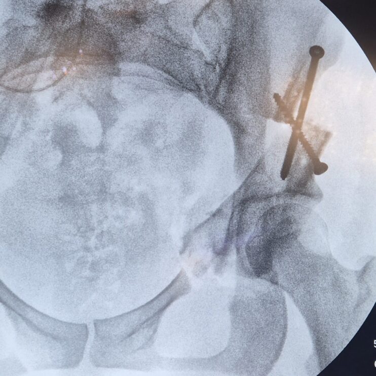 WhatsApp Image 2026-03-14 at 16.14.55