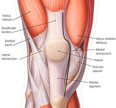 Schéma du genou : tracé de la voie parapatellaire médiale (voie classique), qui passe dans le tendon quadricipital