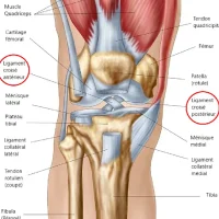 RUPTURE DES LIGAMENTS CROISÉS DU GENOU